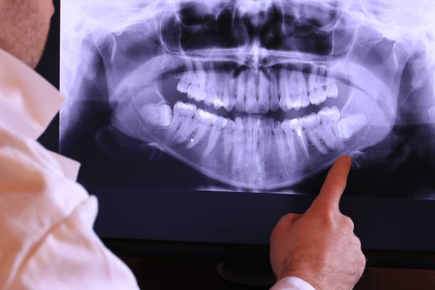 Best Emergency Care for Gum Disease in Bremen, IN