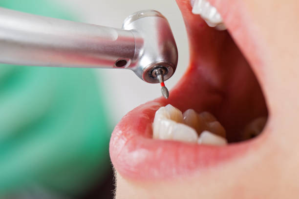 Best Walk-In Emergency Dental Services in Bremen, IN
